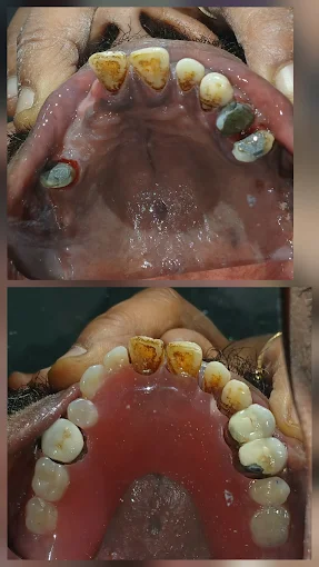 Pooja Smile Care Dental Gallery Image 4
